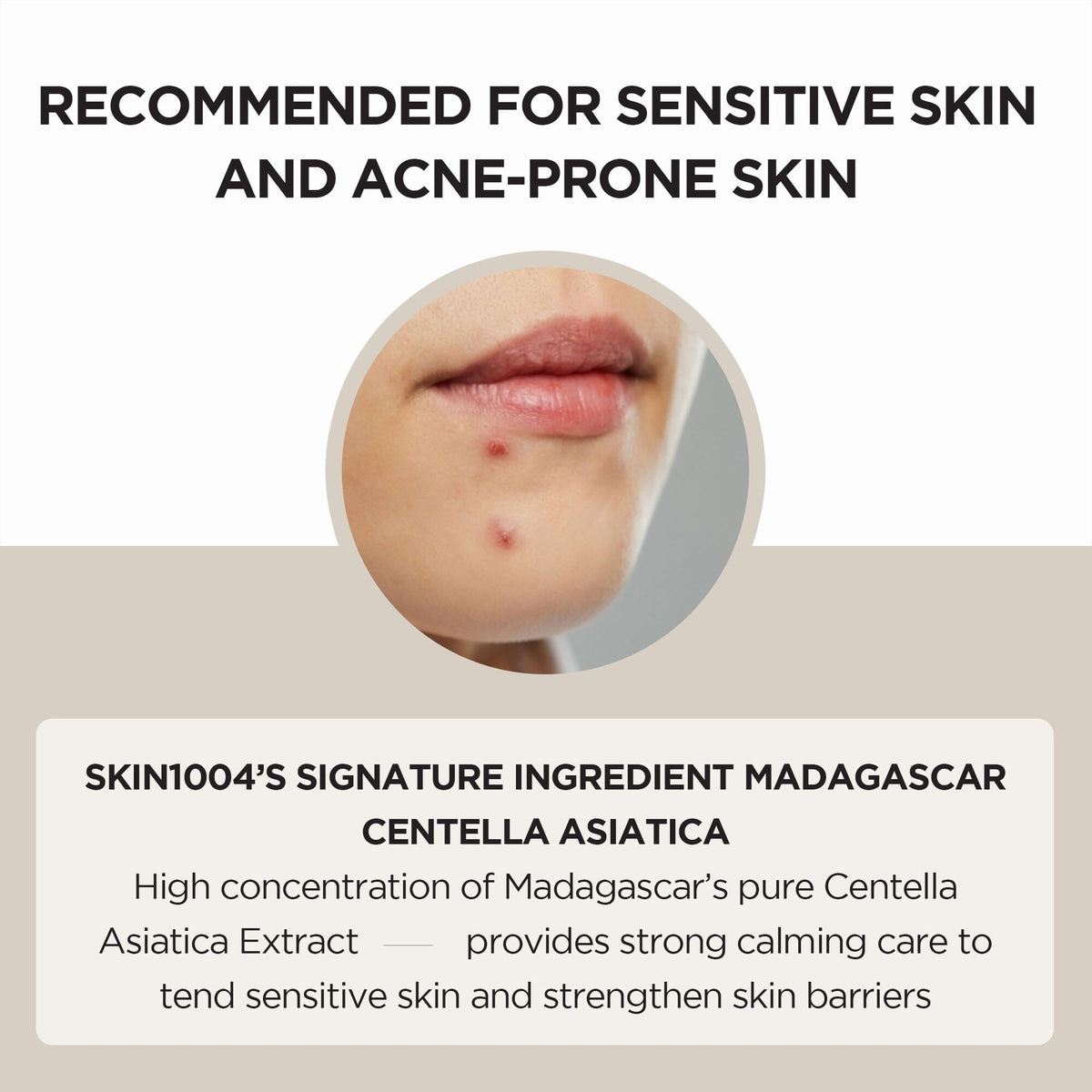 SKIN1004 Madagascar Centella Ampoule 55ml - ORION XO Exclusive