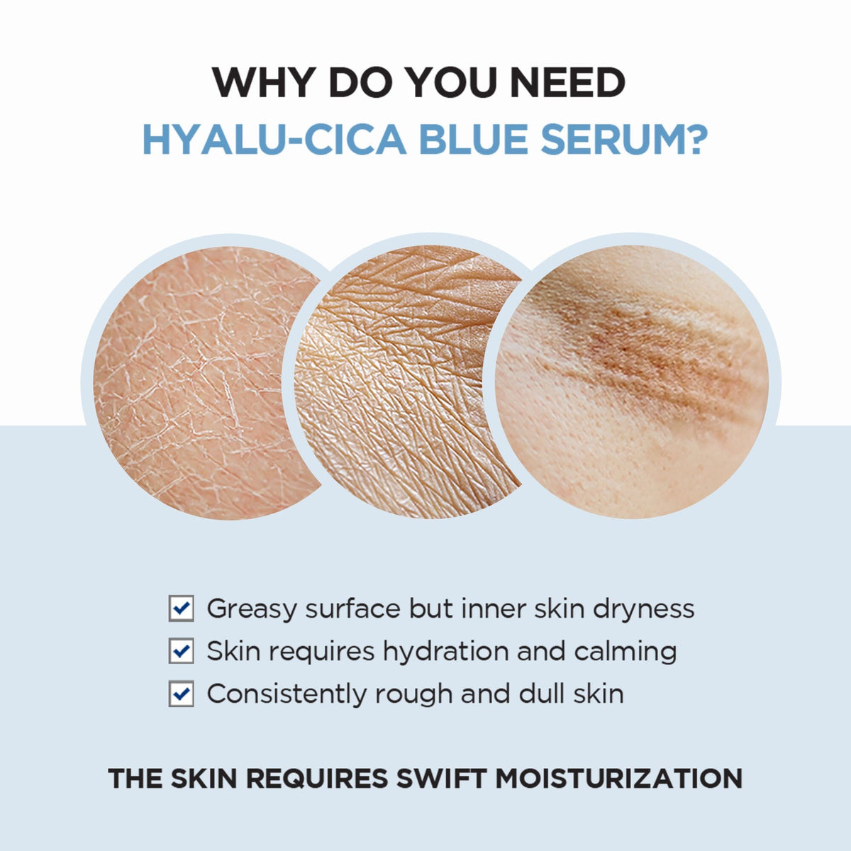 SKIN1004 Madagascar Centella Hyalu-Cica Blue Serum 50ml - ORION XO Exclusive