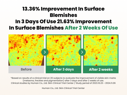 AXIS-Y Dark Spot Correcting Glow Serum Mini 5mI