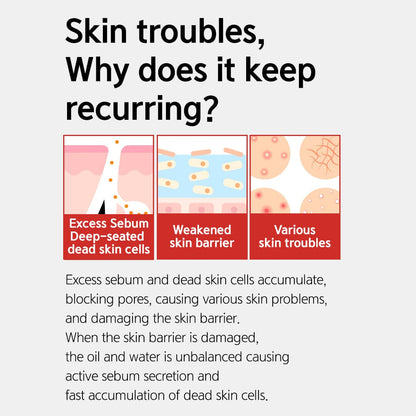 NACIFIC Origin Red Salicylic Acid (Wash-Off) Serum 50ml - ORION XO Exclusive