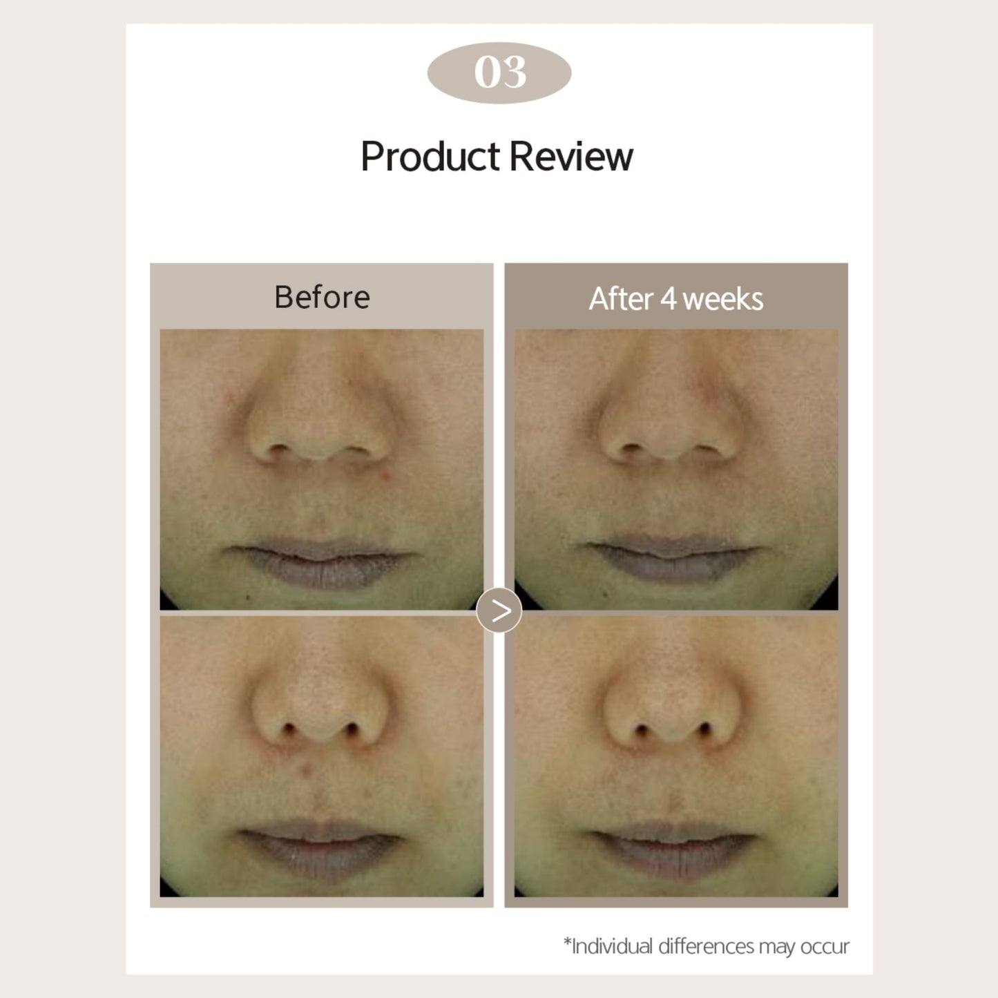 NACIFIC Phyto Niacin Brightening Essence 50ml (5% Niacinamide) - ORION XO Exclusive