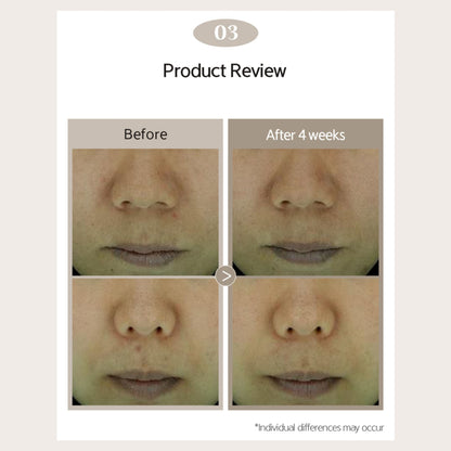 NACIFIC Phyto Niacin Brightening Essence 50ml (5% Niacinamide) - ORION XO Exclusive