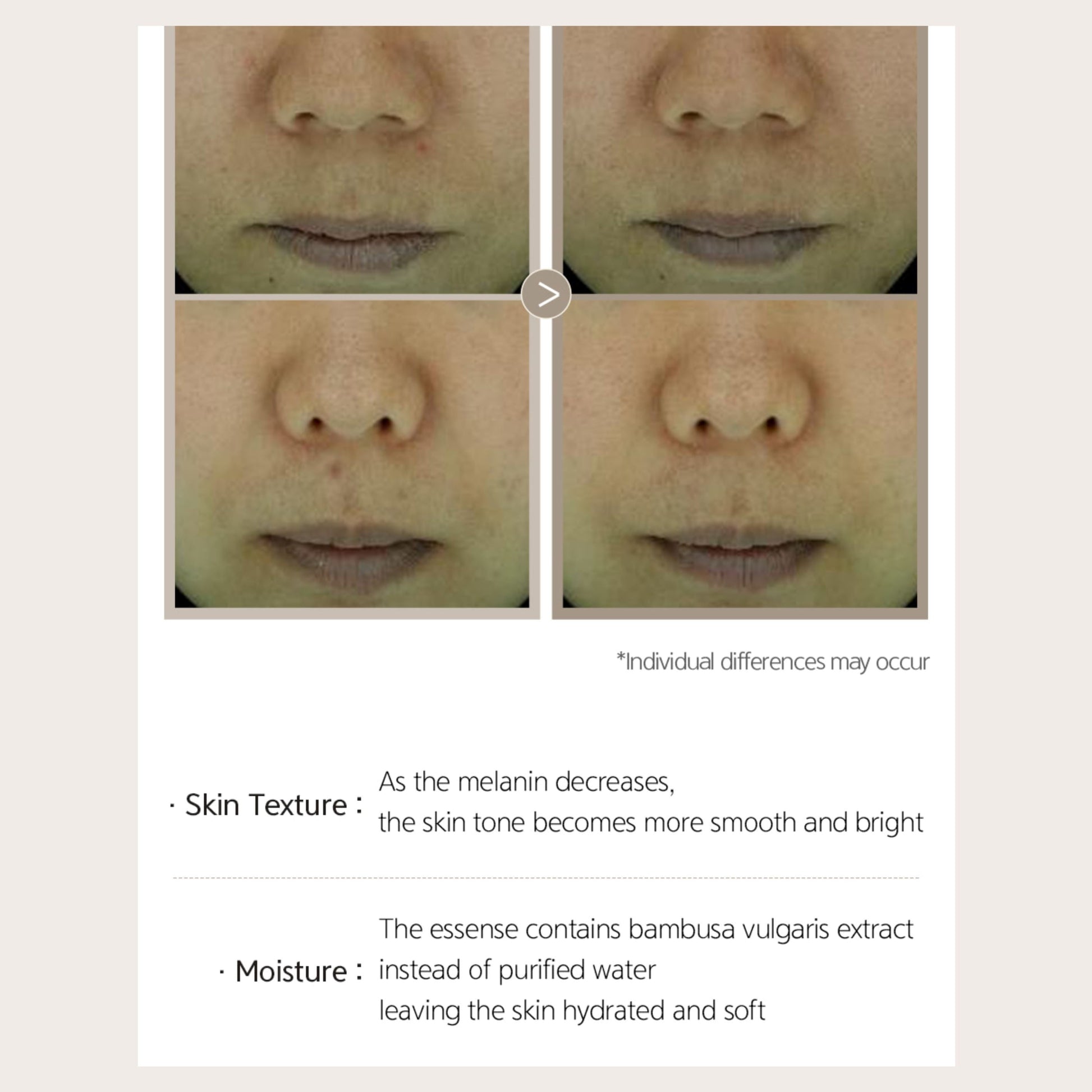 NACIFIC Phyto Niacin Brightening Essence 50ml (5% Niacinamide) - ORION XO Exclusive