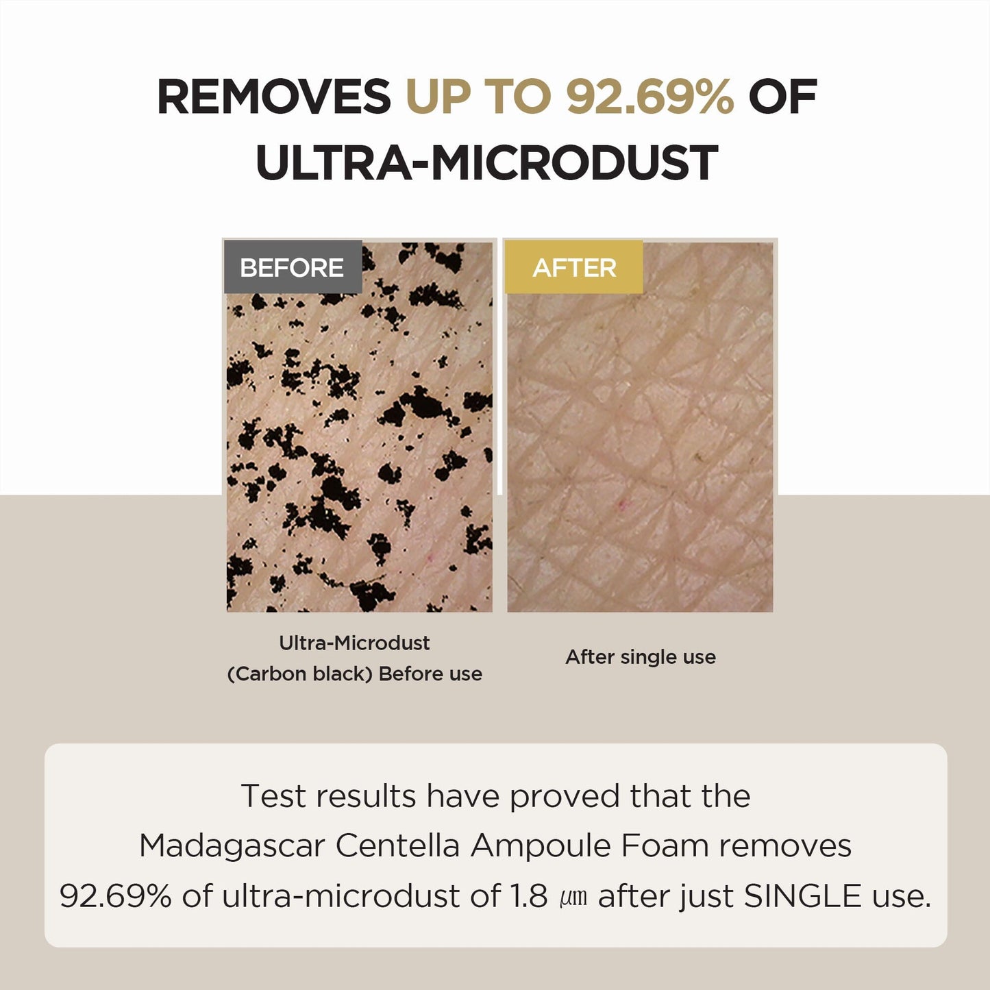 SKIN1004 Madagascar Centella Ampoule Foam 125ml - ORION XO Exclusive