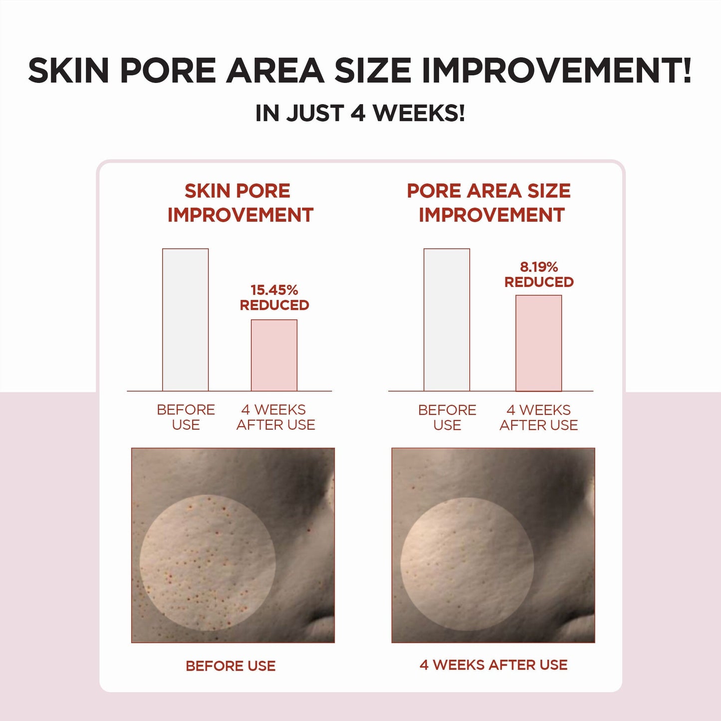 SKIN1004 Madagascar Centella Poremizing Clear Toner 210ml - ORION XO Exclusive