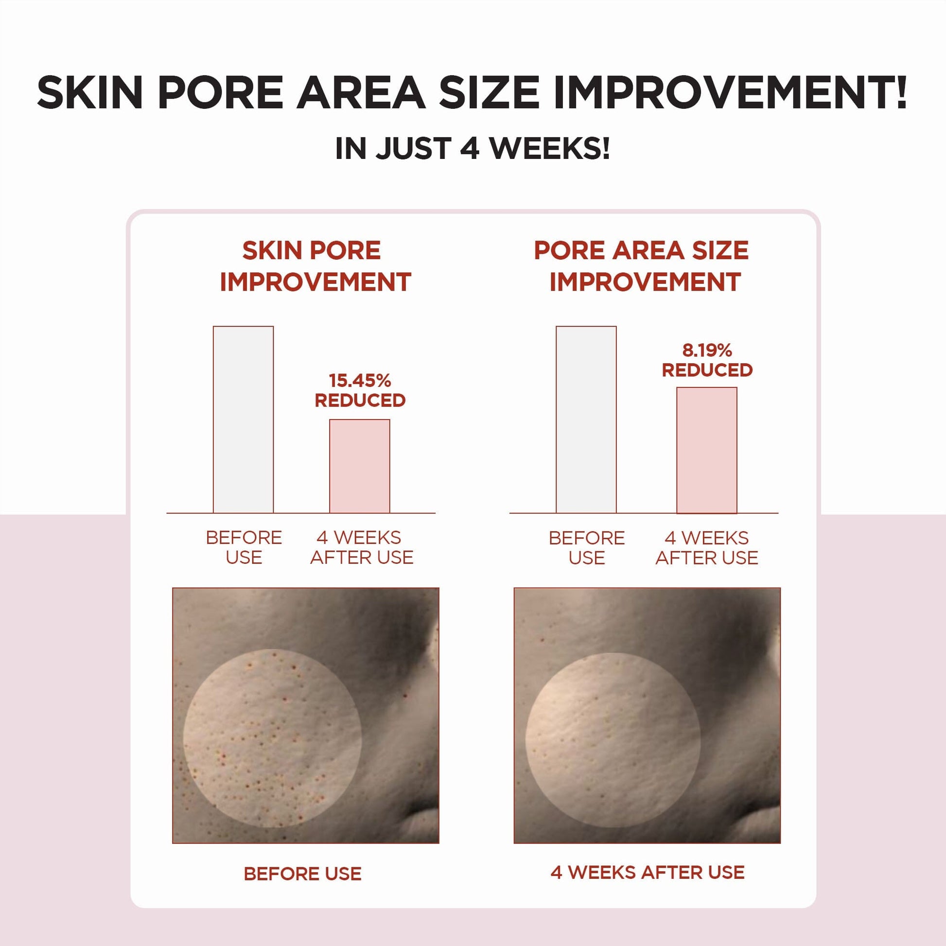 SKIN1004 Madagascar Centella Poremizing Clear Toner 210ml - ORION XO Exclusive