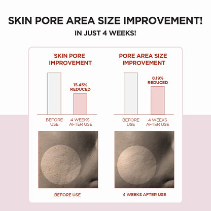 SKIN1004 Madagascar Centella Poremizing Clear Toner 210ml - ORION XO Exclusive